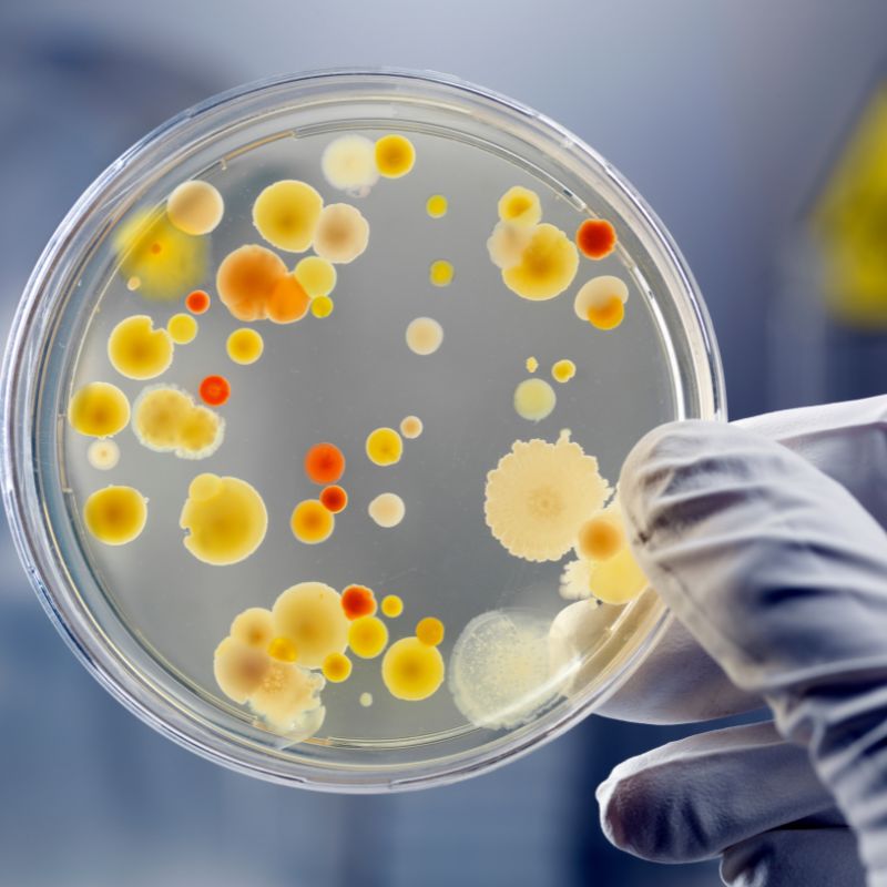 Legionella Bacteria